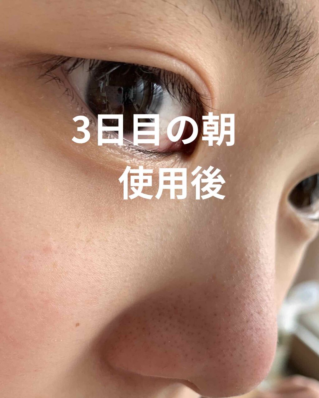 さやぁ on LIPS 「使用前ピントが合ってない可能性あります!毛穴が中々広がらないう..」(2枚目)