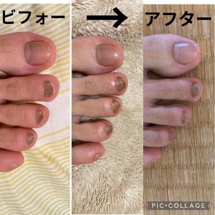 ネイルケアオイル/無印良品/ネイルオイル・トリートメントを使ったクチコミ(4枚目)