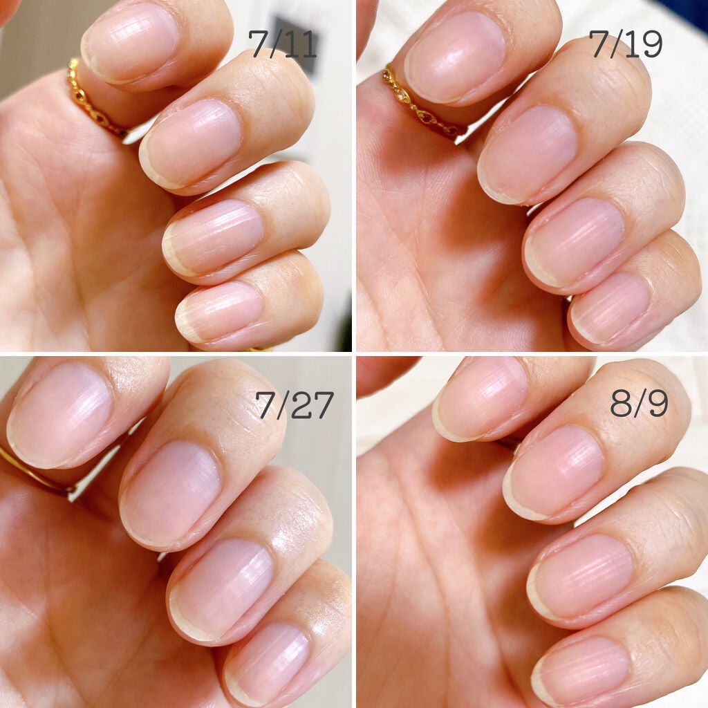 ネイリッチ/DHC/健康サプリメントを使ったクチコミ(4枚目)