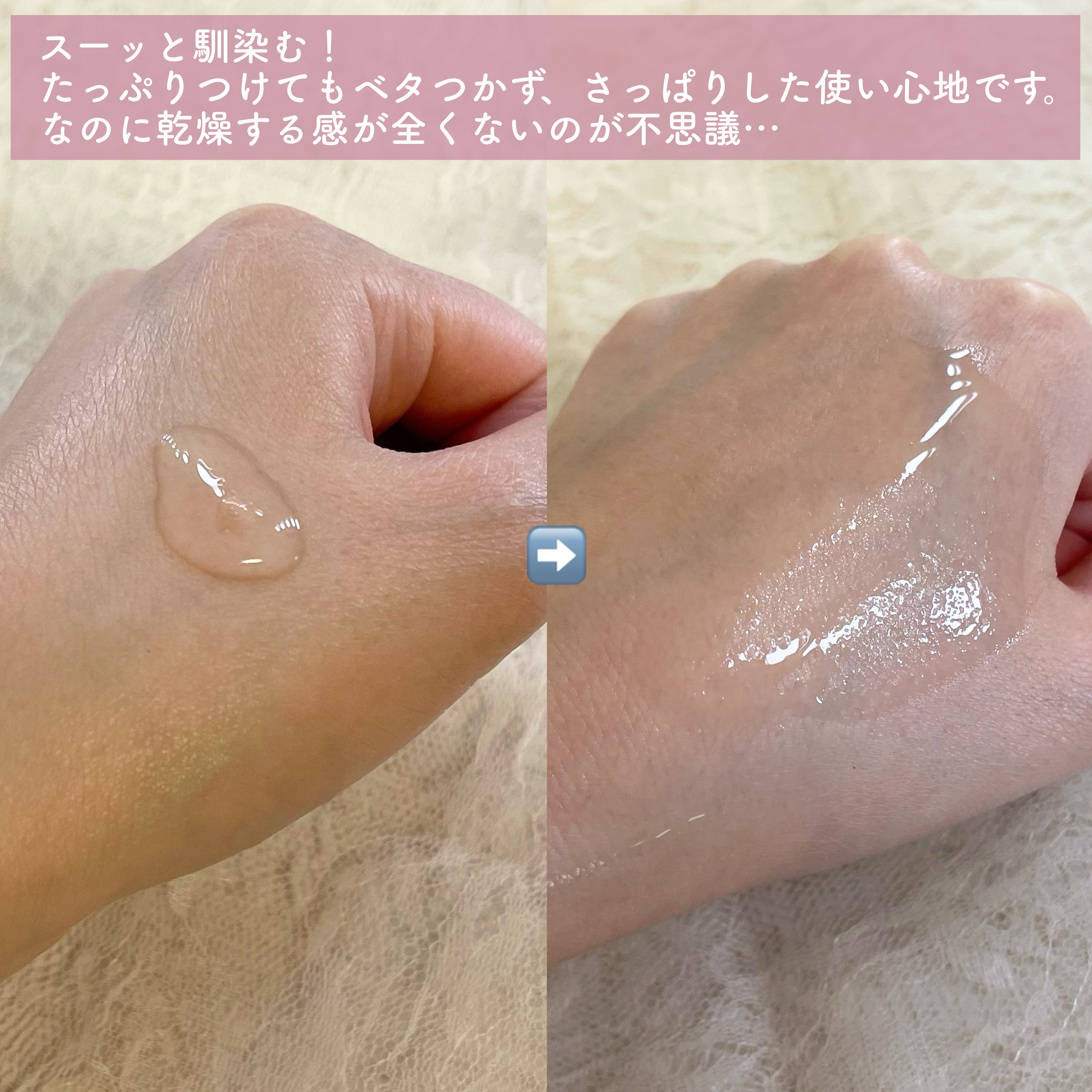 薬用 アクネケア美容液/d プログラム/美容液を使ったクチコミ（3枚目）