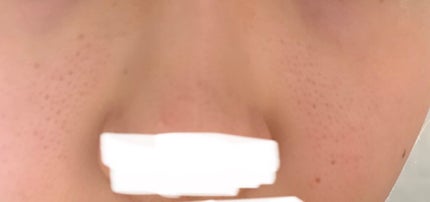 高浸透うるおい化粧液/SQS/化粧水を使ったクチコミ(2枚目)