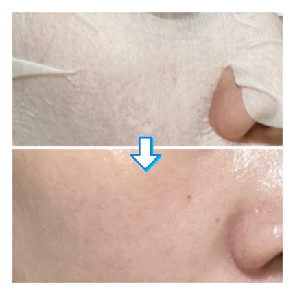 BADECASIL DERMASEAL MASK/23years old/シートマスク・パックを使ったクチコミ(5枚目)