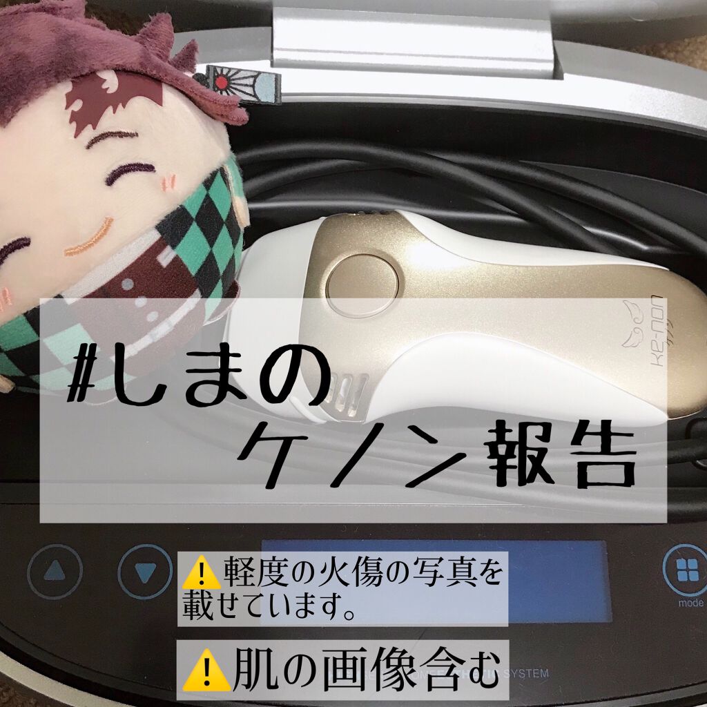 光美容器KE-NON（ケノン） シャンパンゴールド/エムテック/家庭用脱毛器を使ったクチコミ（1枚目）