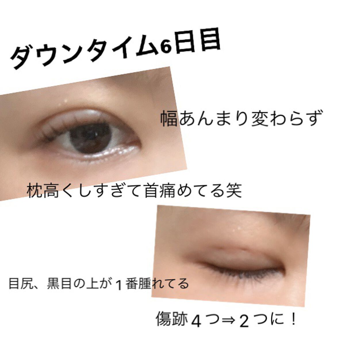 ラッシュアディクト アイラッシュコンディショニングセラム/soaddicted/まつげ美容液を使ったクチコミ(1枚目)