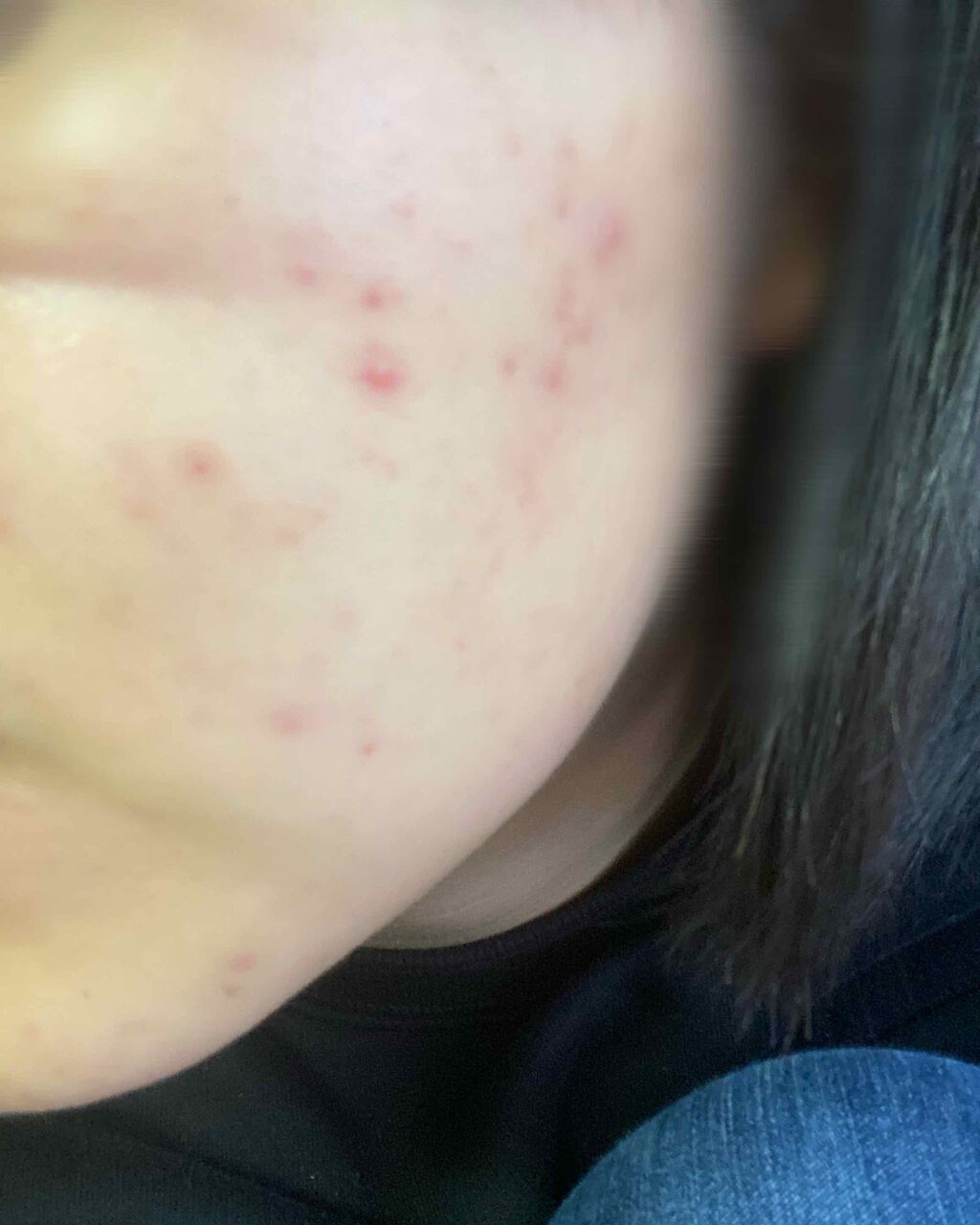 明色美顔水 薬用化粧水/美顔/化粧水を使ったクチコミ(2枚目)