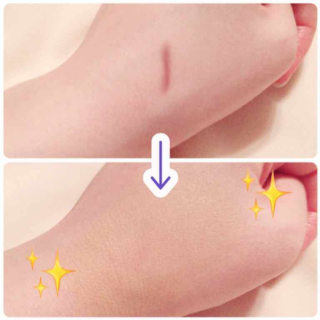 UR GLAM COVER&HIGHLIGHT CONCEALER/U R GLAM/リキッドコンシーラーを使ったクチコミ(3枚目)