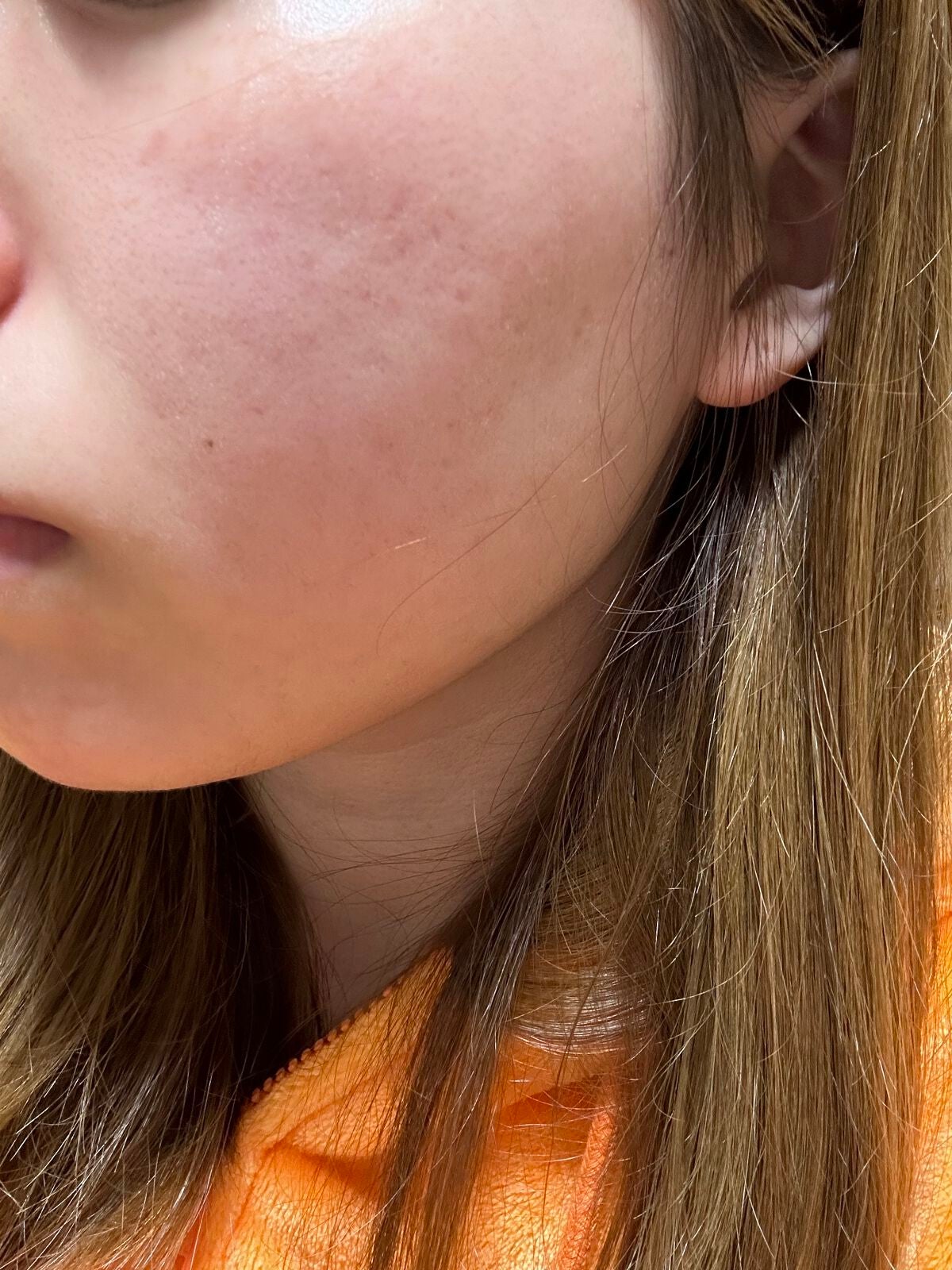 ウオーター/アベンヌ/ミスト状化粧水を使ったクチコミ(4枚目)