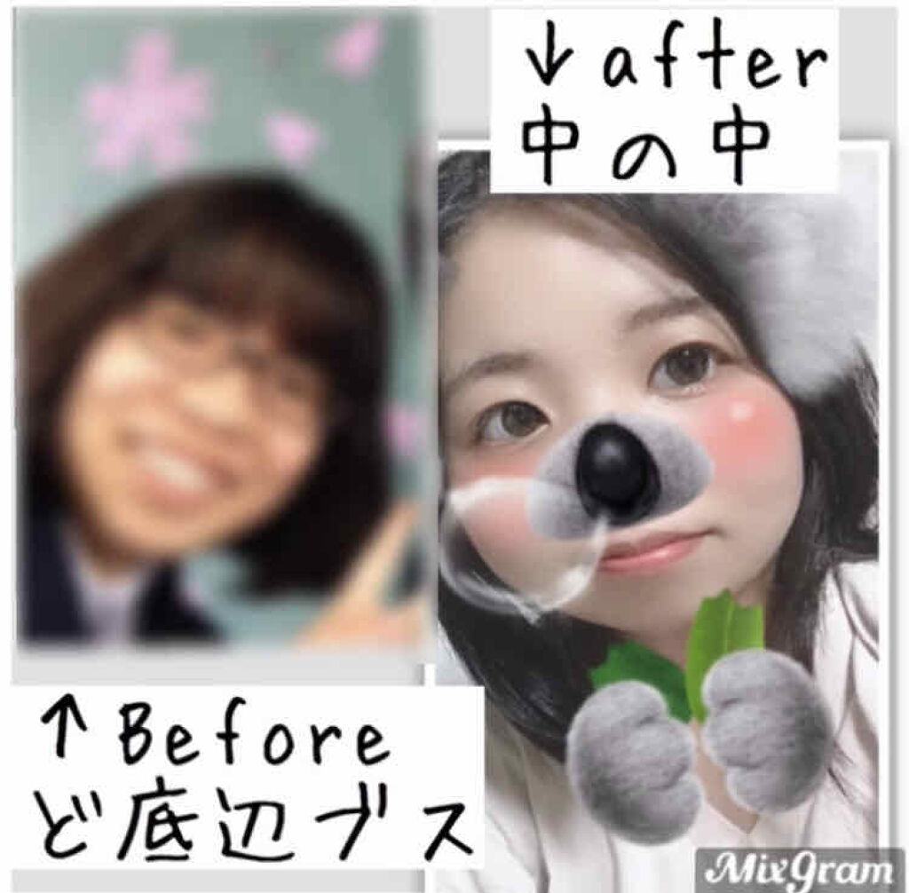 アイビューティー フィクサー WP/アストレア ヴィルゴ/二重まぶた用アイテムを使ったクチコミ（1枚目）