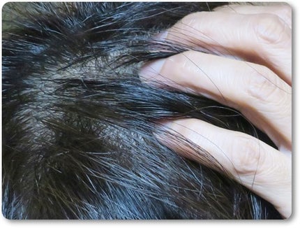 growbio/JYU-KEN/頭皮ローションを使ったクチコミ(4枚目)