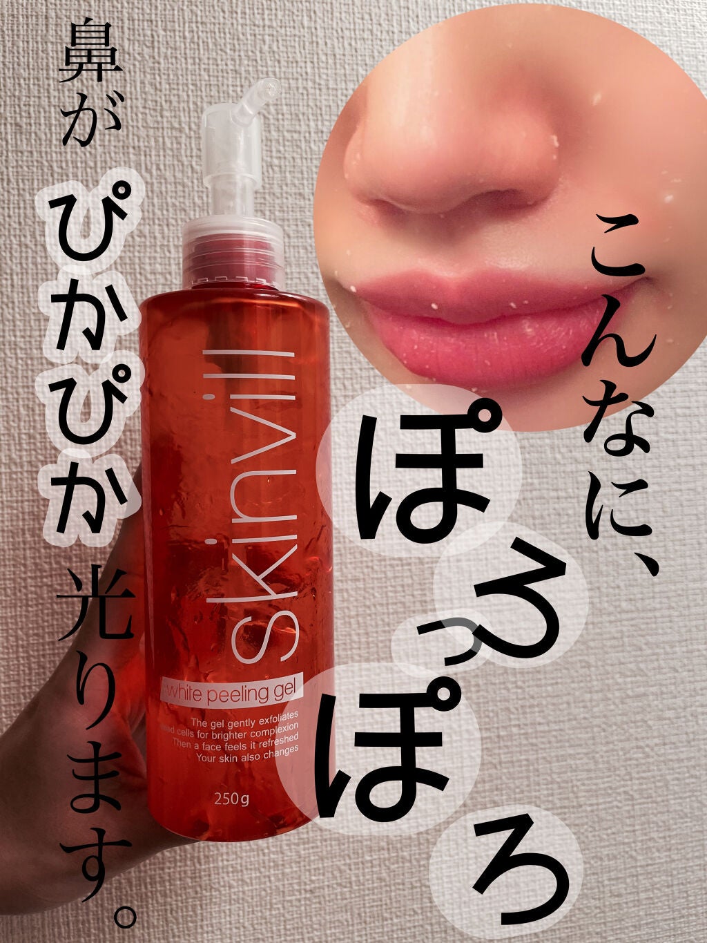 ホワイトピーリングジェル/skinvill/ピーリングを使ったクチコミ(1枚目)