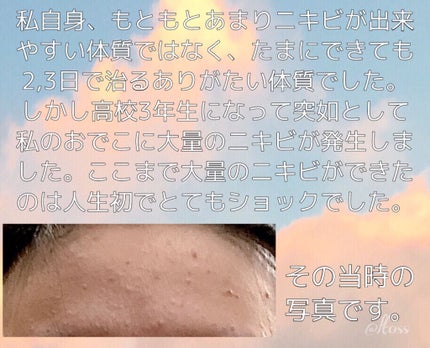 DHC ビタミンCハードカプセル/DHC/美容サプリメントを使ったクチコミ(2枚目)