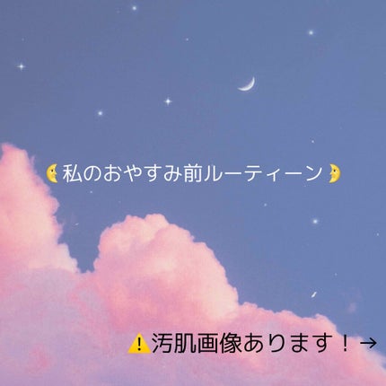 モイスチャー ミストローションII(しっとり)/アルージェ/ミスト状化粧水を使ったクチコミ(1枚目)