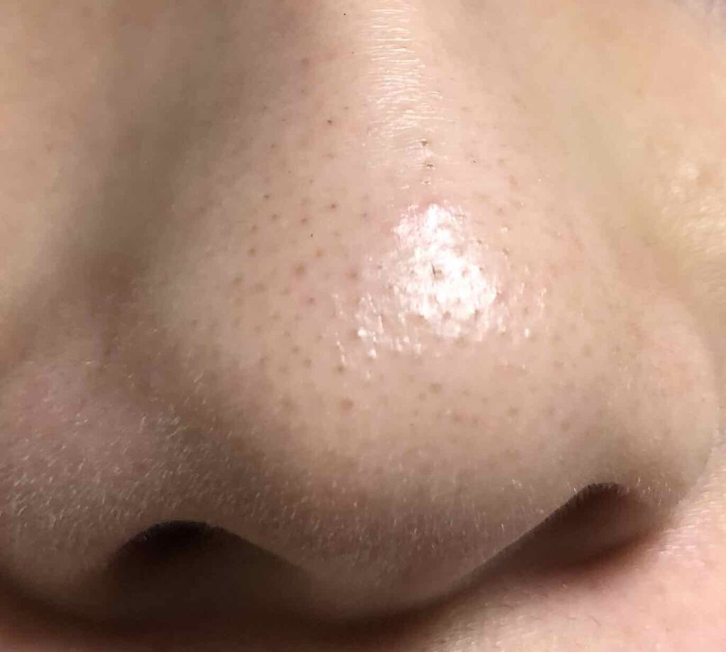 マイルドピーリングパッド/PUFFY POD/トナーパッドを使ったクチコミ（2枚目）