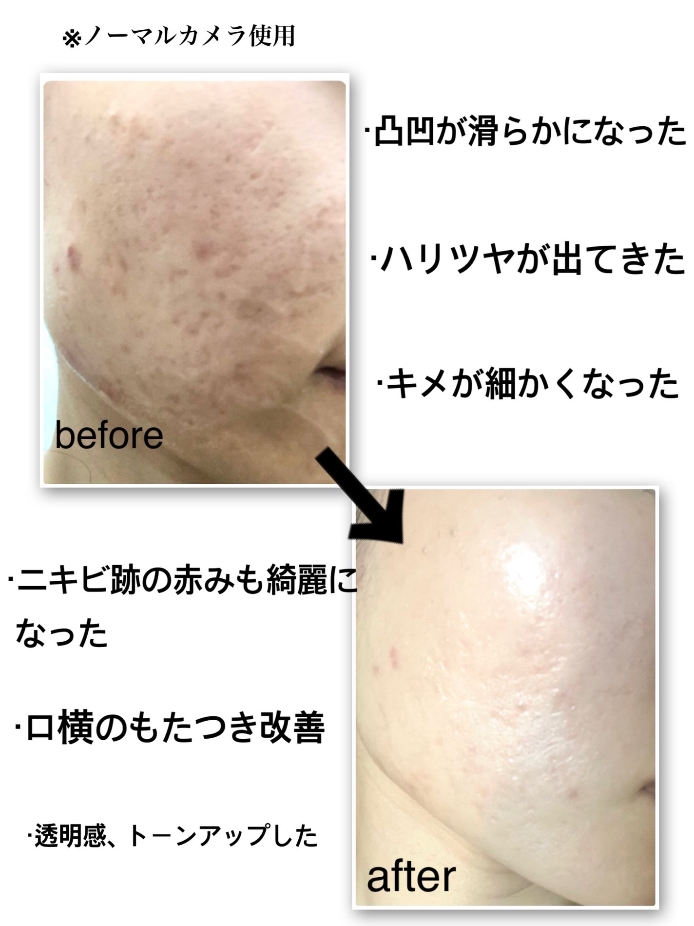 AGE-R ブースタープロ|MEDICUBEの口コミ - #MEDICUBE #AGE-R_ AGE-R ブースタープロ|MEDICUBEの口コミ - #MEDICUBE #AGE-R_