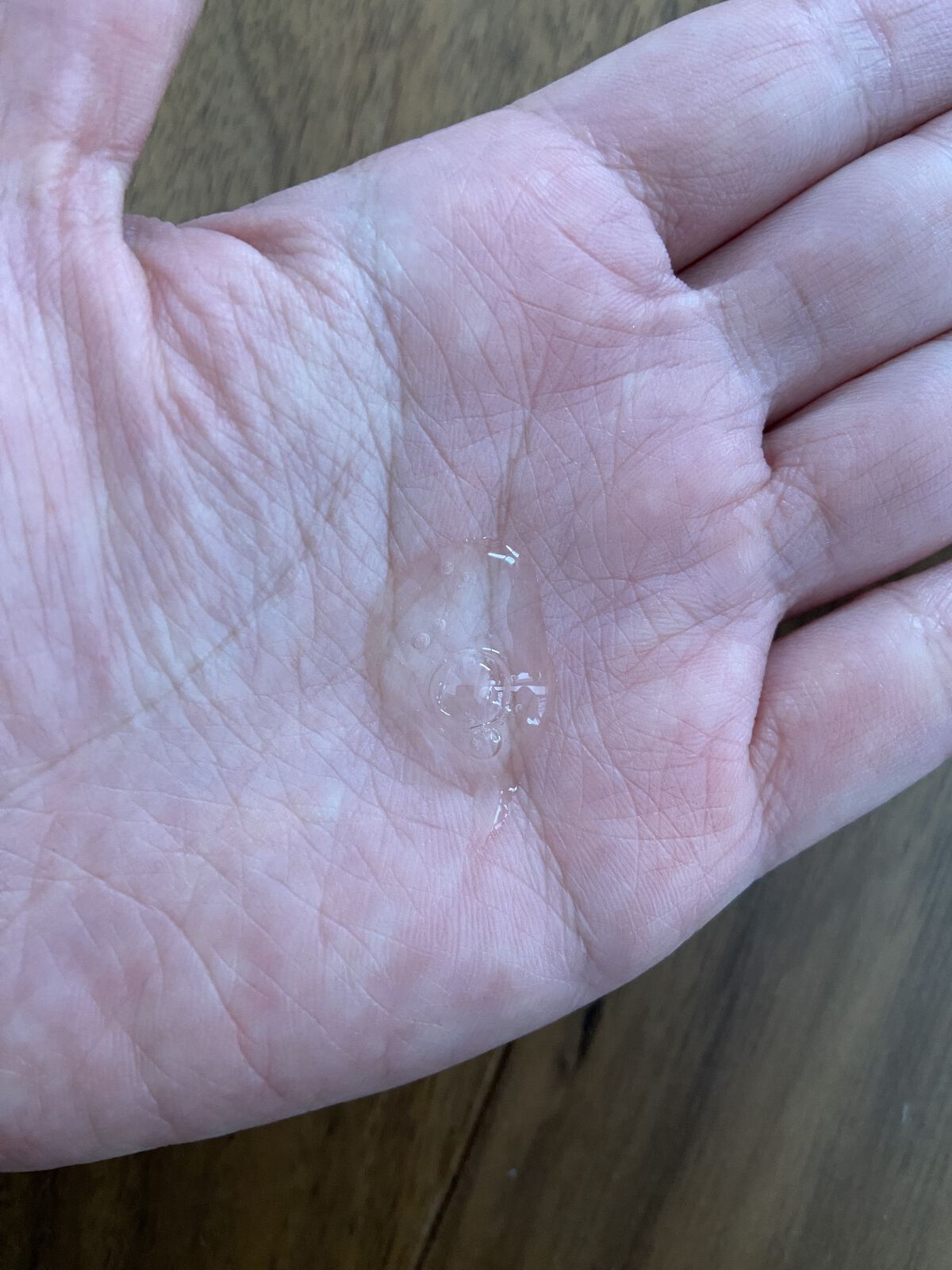 ナノグロウリッチ/iqumore/頭皮ローションを使ったクチコミ（2枚目）