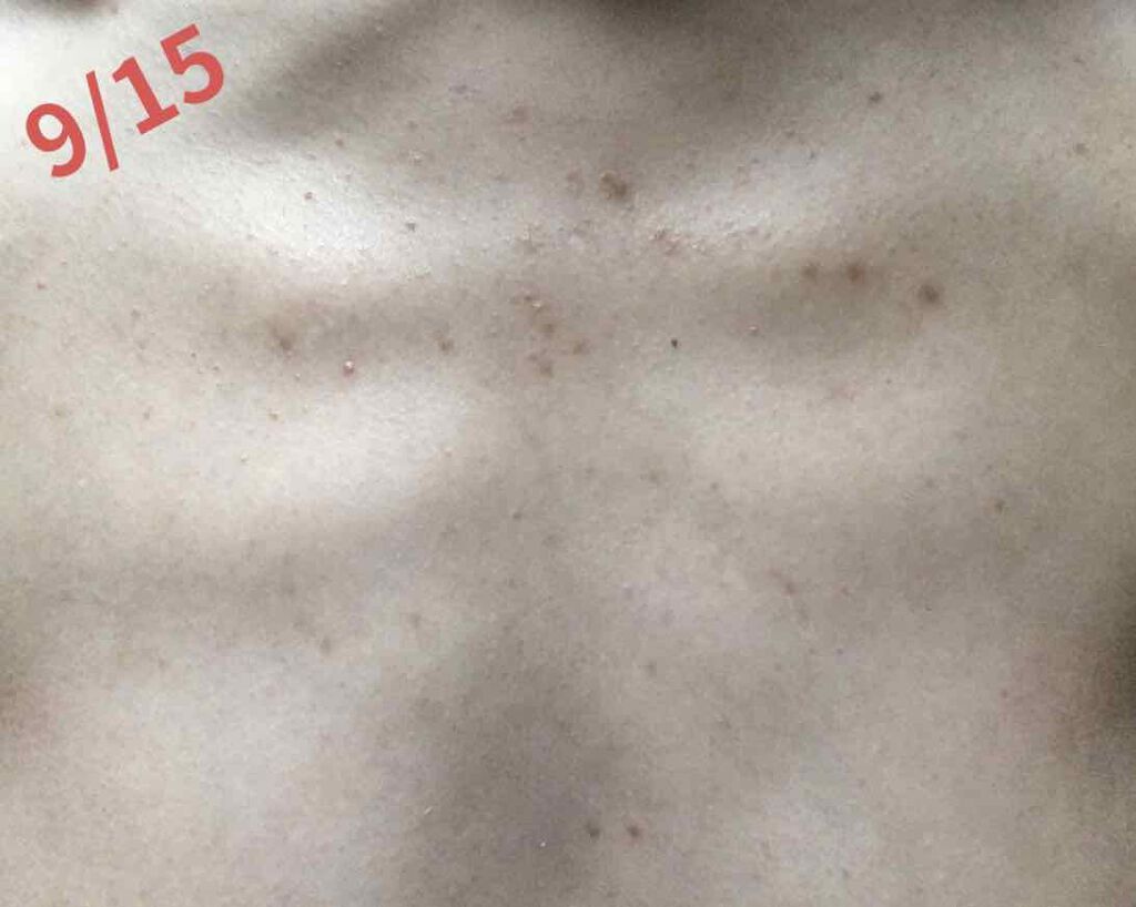 DHC マルチビタミン/DHC/美容サプリメントを使ったクチコミ(2枚目)