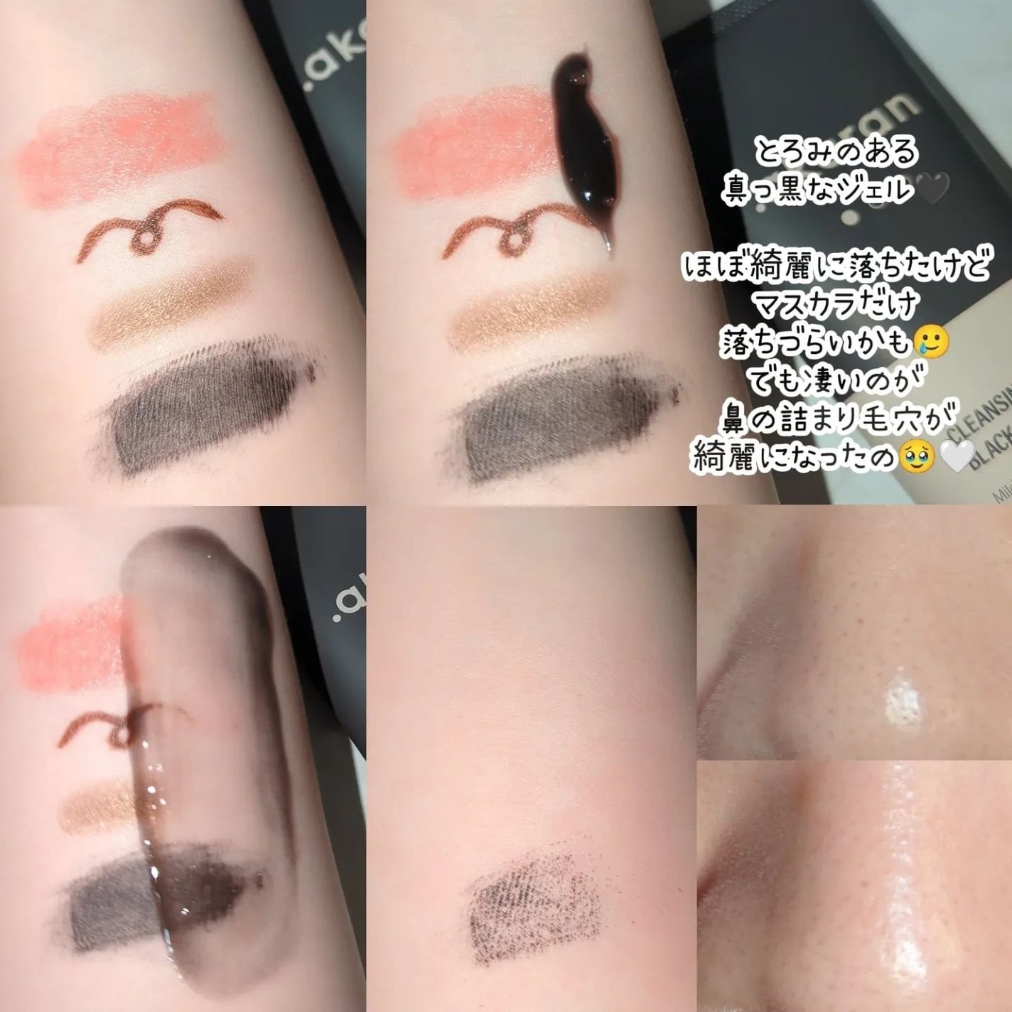 ブラックジェルクレンジング/.akaran/クレンジングジェルを使ったクチコミ(3枚目)