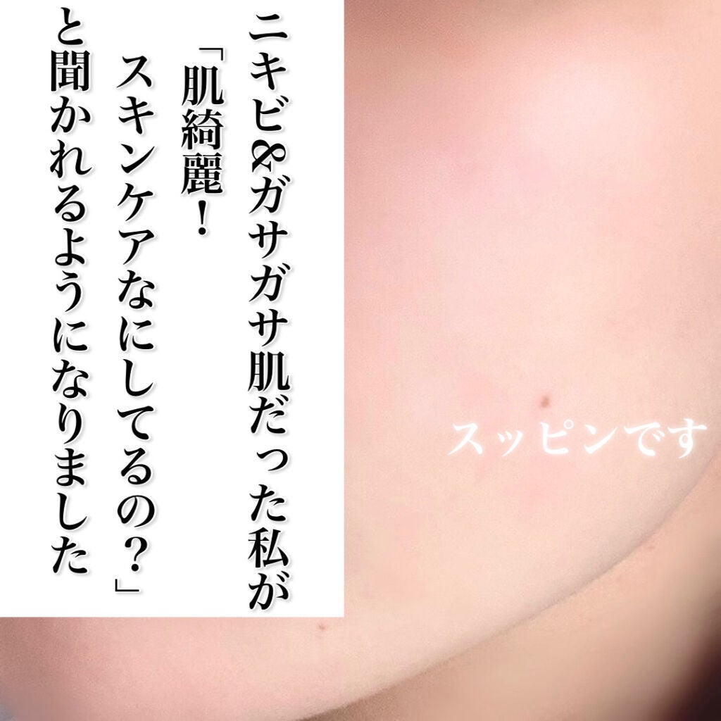 潤浸保湿 化粧水 III とてもしっとり/キュレル/化粧水を使ったクチコミ(1枚目)