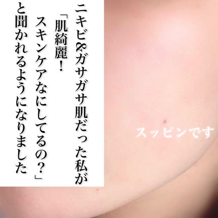 潤浸保湿 化粧水 III とてもしっとり/キュレル/化粧水を使ったクチコミ(1枚目)