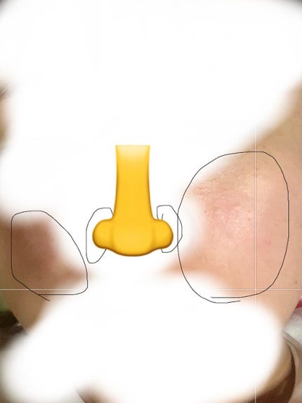 明色美顔水 薬用化粧水/美顔/化粧水を使ったクチコミ(2枚目)