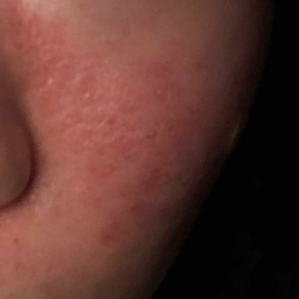 アミノモイスト トライアルセット/ミノン/トライアルキットを使ったクチコミ(4枚目)