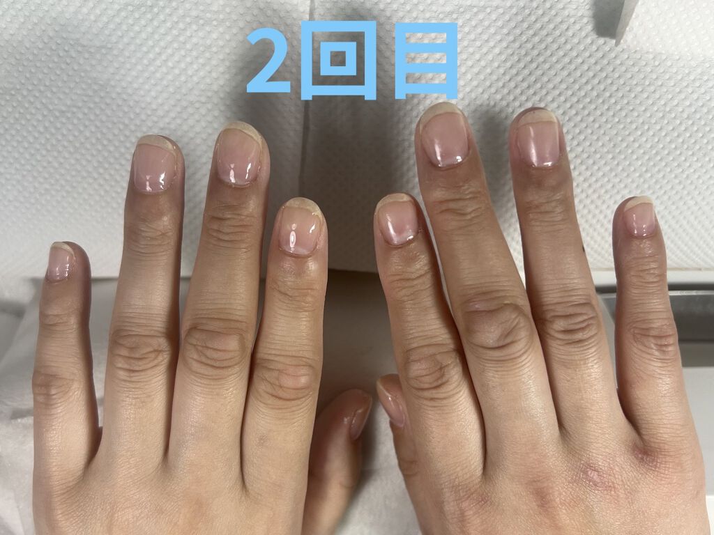 を使ったクチコミ（2枚目）