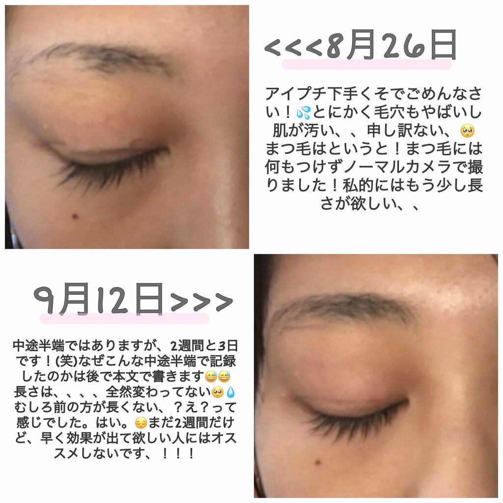 まつげ美容液EX/CEZANNE/まつげ美容液を使ったクチコミ(2枚目)