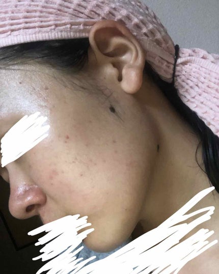 スキンケア洗顔料 リッチモイスチャー/ビオレ/洗顔フォームを使ったクチコミ(1枚目)