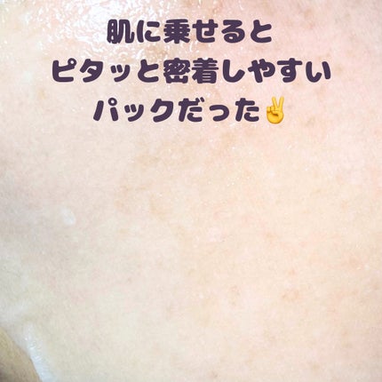 ガラクナイアシン エッセンスマスク/manyo/シートマスク・パックを使ったクチコミ(5枚目)