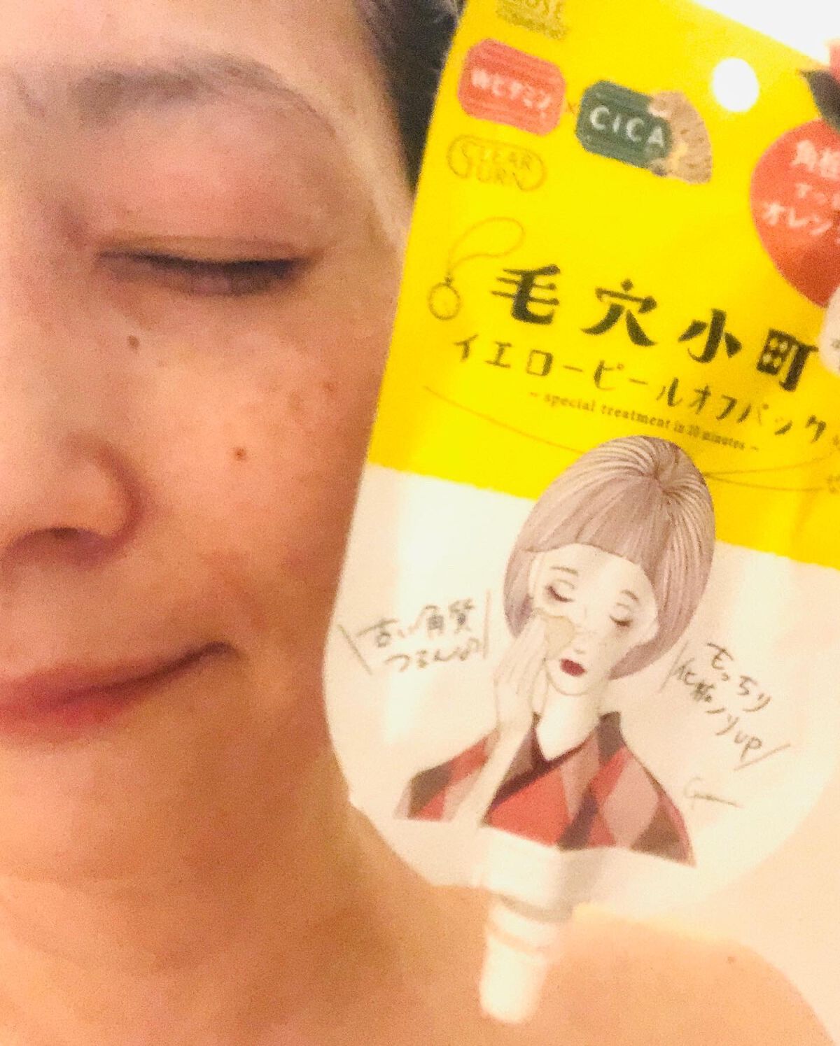 毛穴小町 イエローピールオフパック/クリアターン/ピーリングを使ったクチコミ(3枚目)