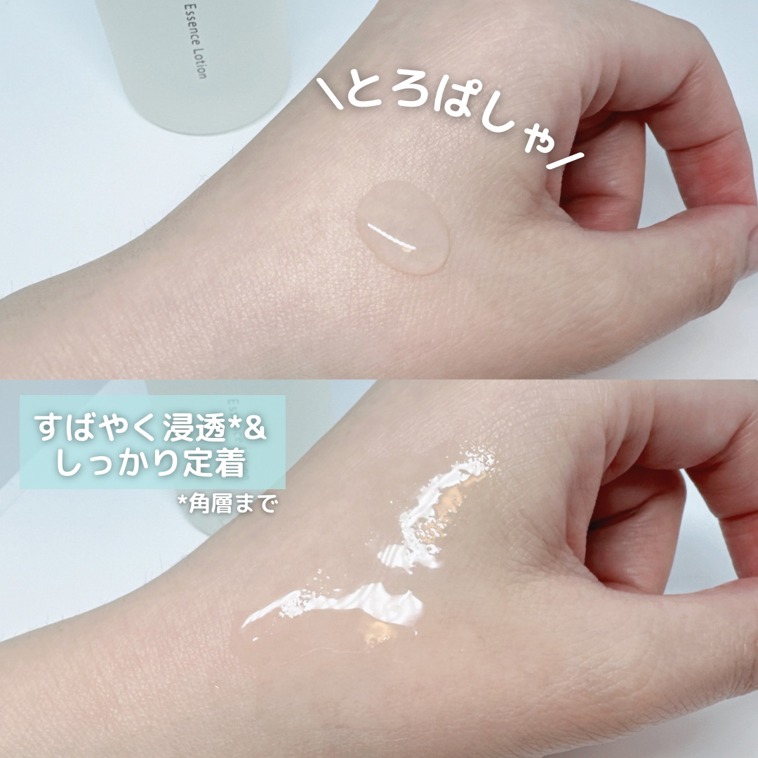 オルビスユー エッセンスローション /オルビス/化粧水を使ったクチコミ（2枚目）