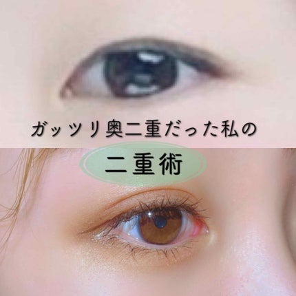 肌色タイプ/バンドエイド/その他を使ったクチコミ(1枚目)