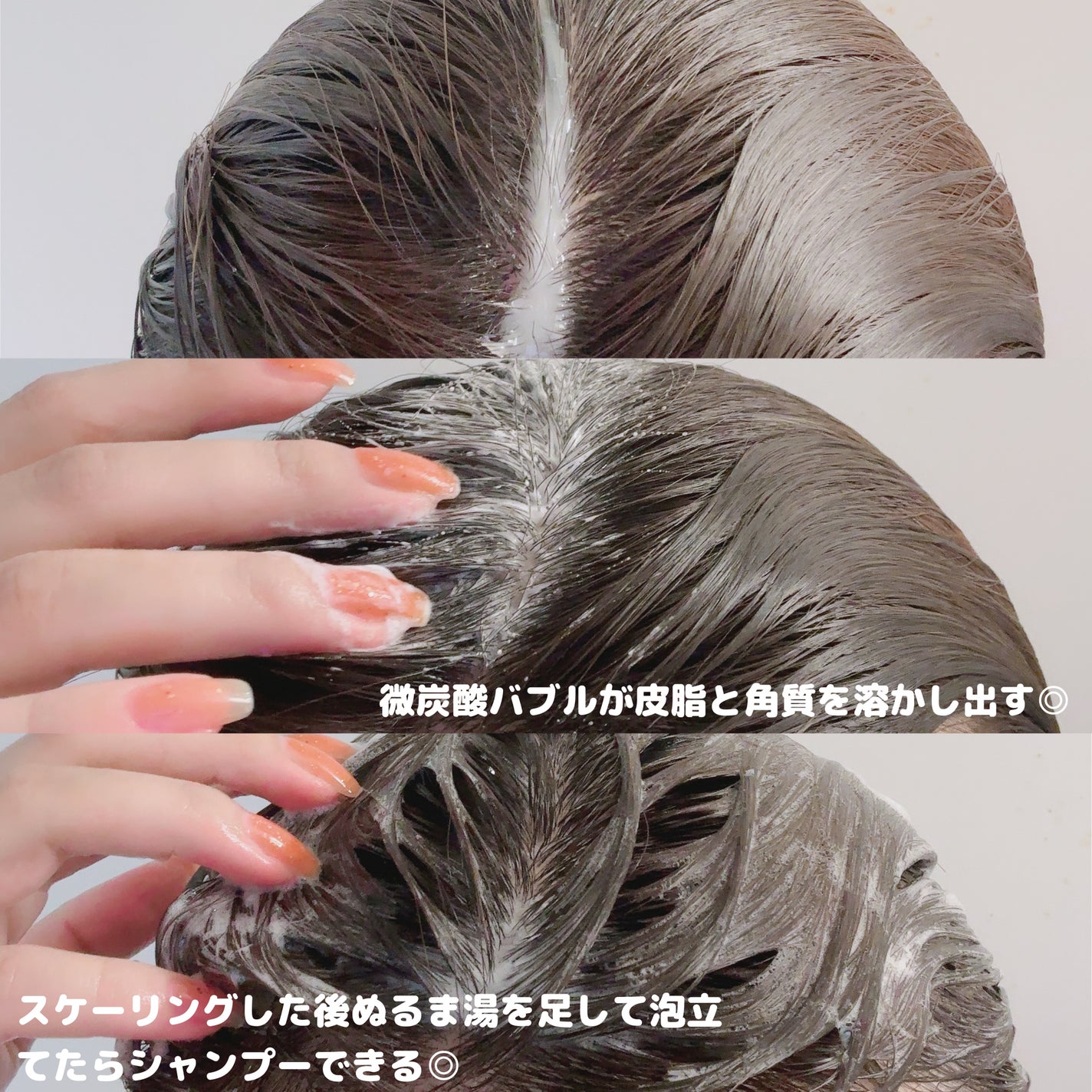 スパークリングスカルプスケーラー/ミンツリー/頭皮ケアを使ったクチコミ(2枚目)