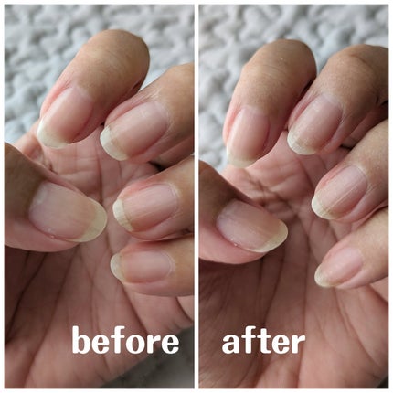 エテュセ クイックケアコート/ettusais/ネイルオイル・トリートメントを使ったクチコミ(3枚目)