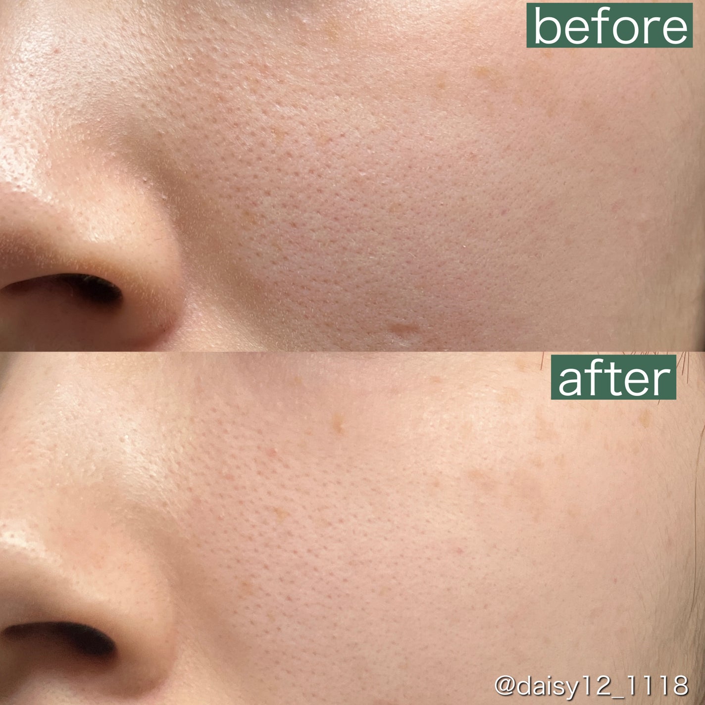 リードルショット リフティングセラム/VT/美容液を使ったクチコミ(8枚目)