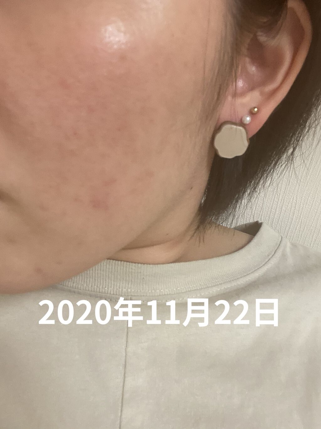 明色美顔水 薬用化粧水/美顔/化粧水を使ったクチコミ（3枚目）