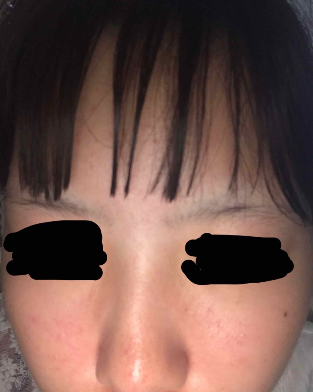 ハトムギ化粧水(ナチュリエ スキンコンディショナー R )/ナチュリエ/化粧水を使ったクチコミ（2枚目）