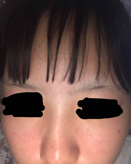 ハトムギ化粧水(ナチュリエ スキンコンディショナー R )/ナチュリエ/化粧水を使ったクチコミ(2枚目)