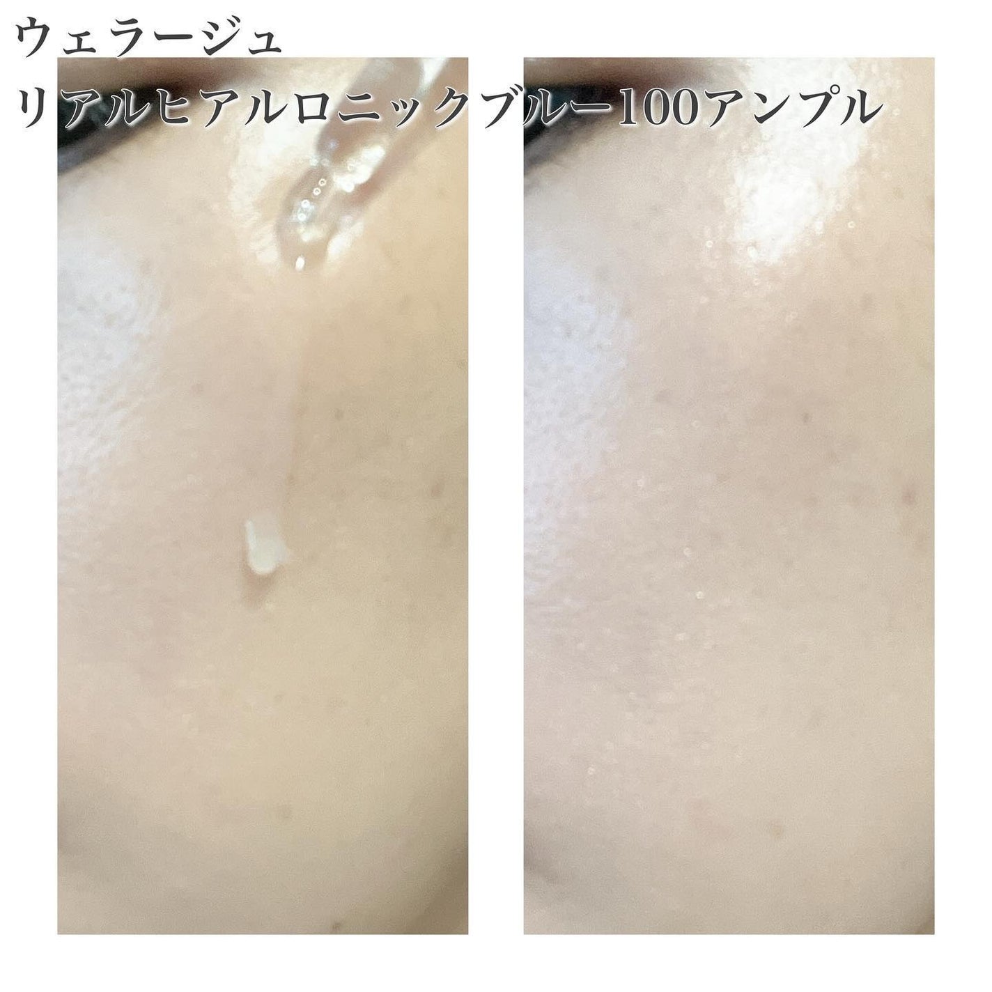 リアルヒアルロニックブルーアンプル 100/Wellage/美容液を使ったクチコミ(7枚目)