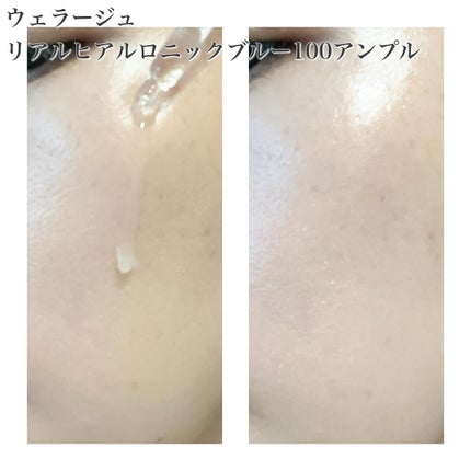 リアルヒアルロニックブルーアンプル 100/Wellage/美容液を使ったクチコミ(7枚目)