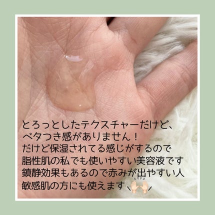 ドクダミ80%スージングアンプル/Anua/美容液を使ったクチコミ(2枚目)