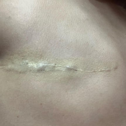 マーシュフィールド SC ボディカバーファンデN/マーシュ・フィールド/クリーム・エマルジョンファンデーションを使ったクチコミ(2枚目)