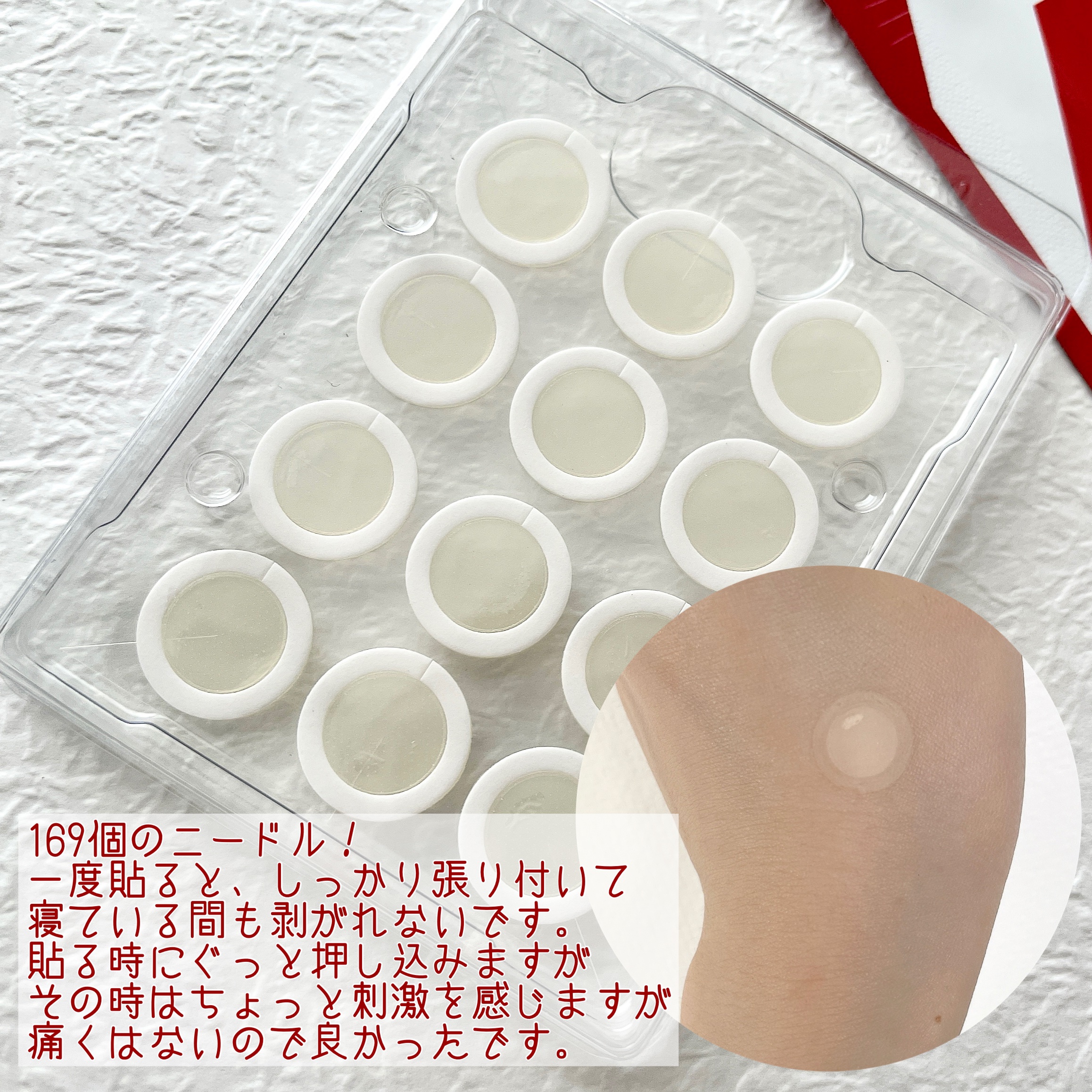 エーキュアショットスポットパッチ/obsero/にきびパッチを使ったクチコミ（3枚目）