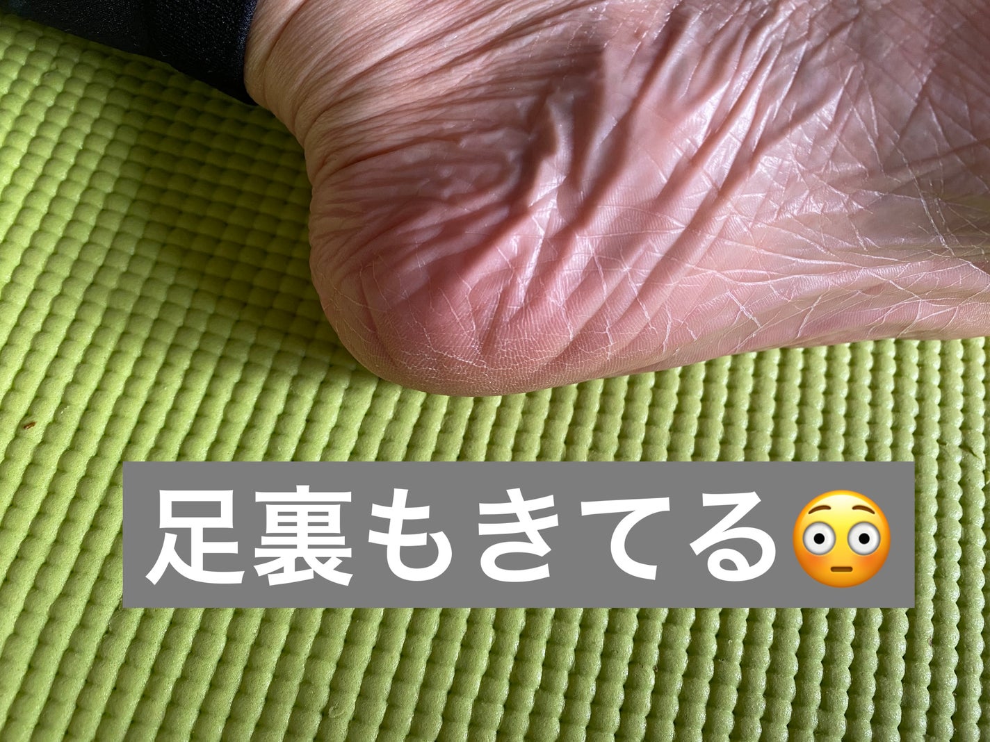 イージーパックSPT 30分タイプ/ベビーフット/レッグ・フットケアを使ったクチコミ(4枚目)