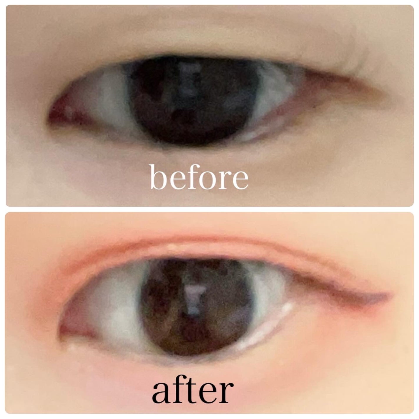 フリーファイバー120 スタンダードタイプ /メザイク/二重まぶた用アイテムを使ったクチコミ(4枚目)