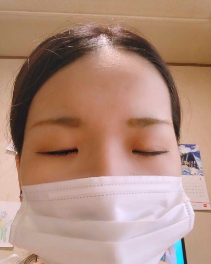 のびーるアイテープ(絆創膏タイプ、レギュラー)/DAISO/二重まぶた用アイテムを使ったクチコミ(2枚目)