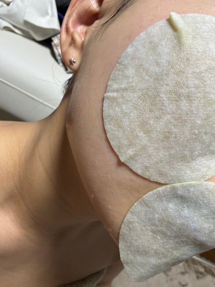 ピュアアルテミシアカーミングパッド/HANYUL(ハンユル)/トナーパッドを使ったクチコミ(4枚目)