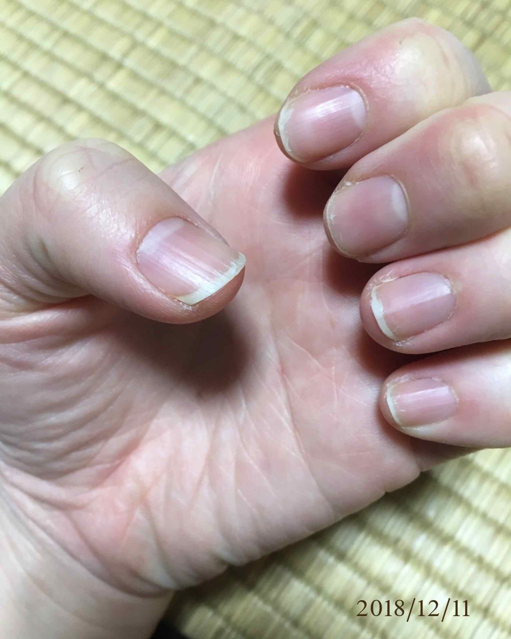 ネイルトリートメント R/ネイルネイル/ネイルオイル・トリートメントを使ったクチコミ（3枚目）