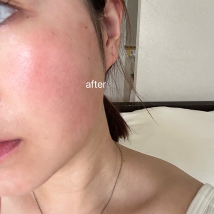 サミュ PHセンシティブクリーム/SAM'U/フェイスクリームを使ったクチコミ(5枚目)