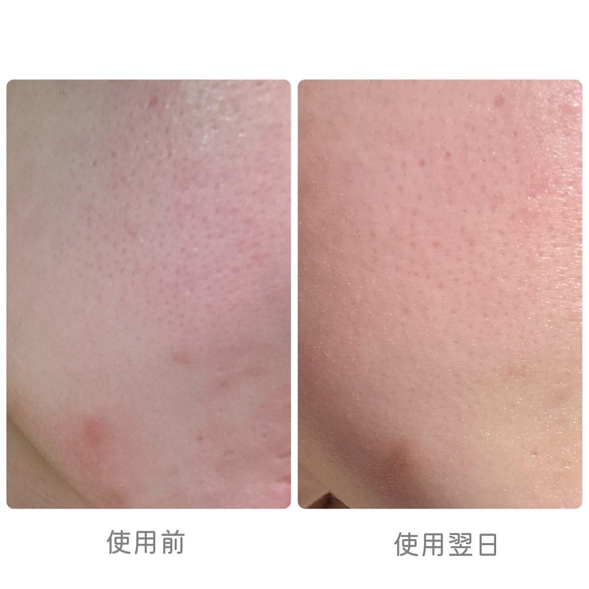 ゼロ毛穴1DAYセラム/MEDICUBE/美容液を使ったクチコミ(4枚目)